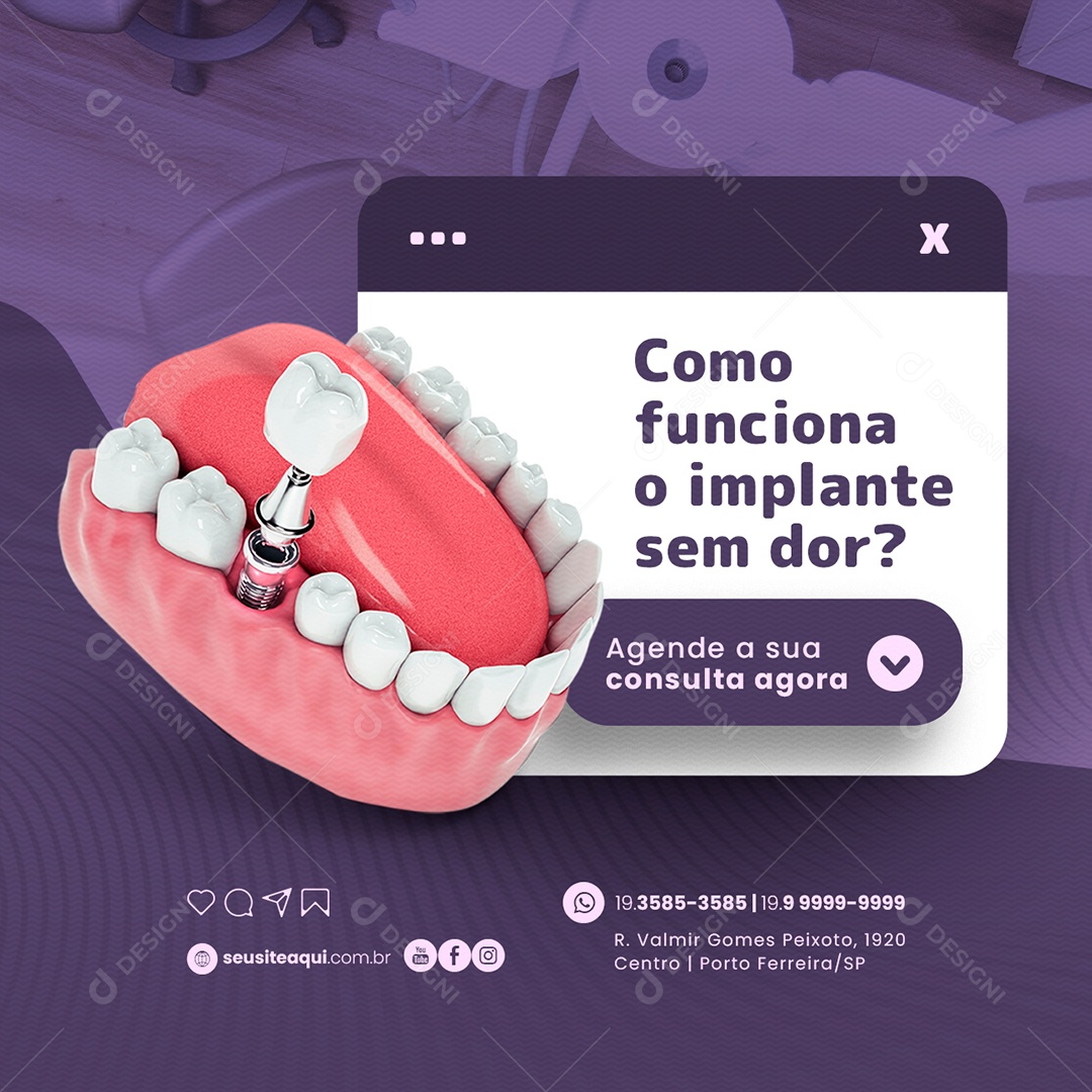 Como Funciona o Implante sem Dor Dentista Social Media PSD Editável