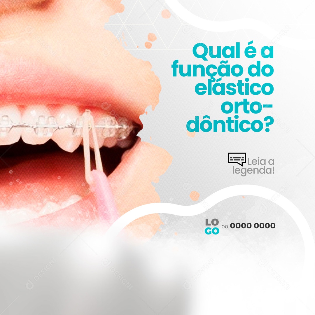 Qual é a Função do Elástico Ortodôntico? Consultório Odontológicos Dentista Social Media PSD Editável