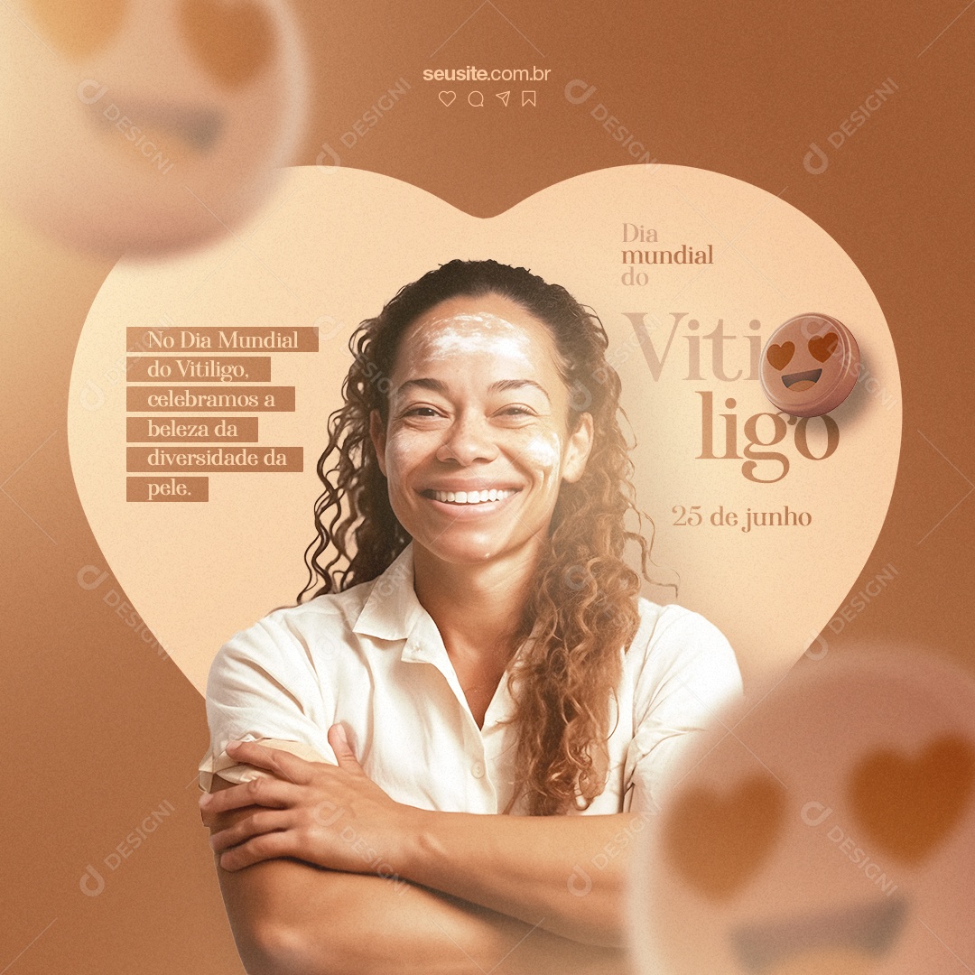 No Dia Mundial Do Vitiligo Do Vitiligo Celebramos A Beleza Social Media PSD Editável