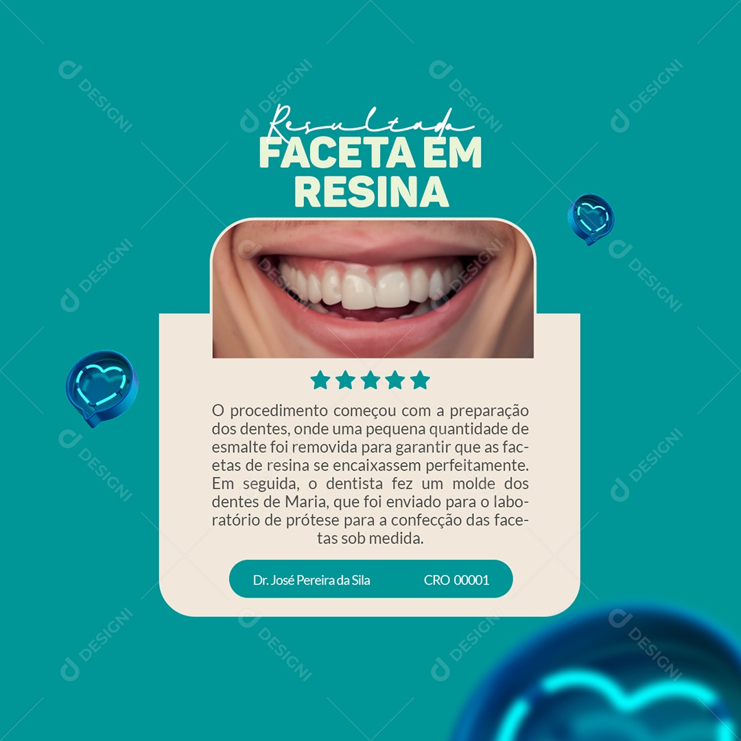 Clínica Odontológica Resultado Faceta em Resina Feedback Social Media PSD Editável