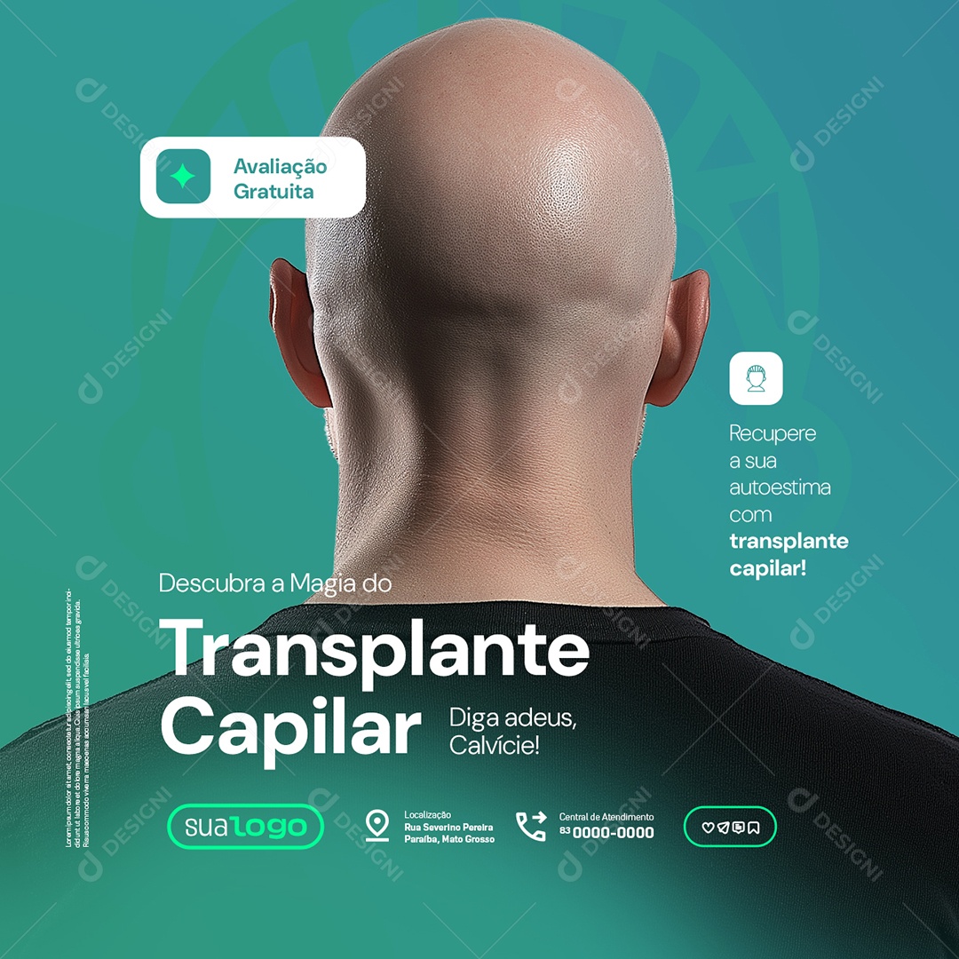 Descubra a Magia do Transplante Capilar Social Media PSD Editável