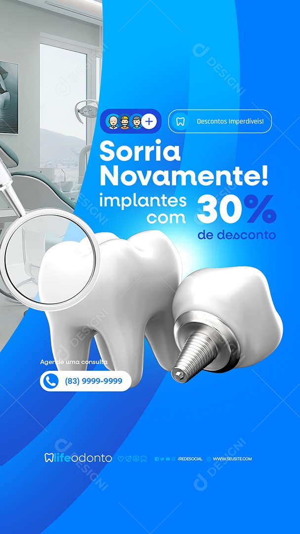 Story Dentista Sorria Novamente Implante com 30% Social Media PSD Editável